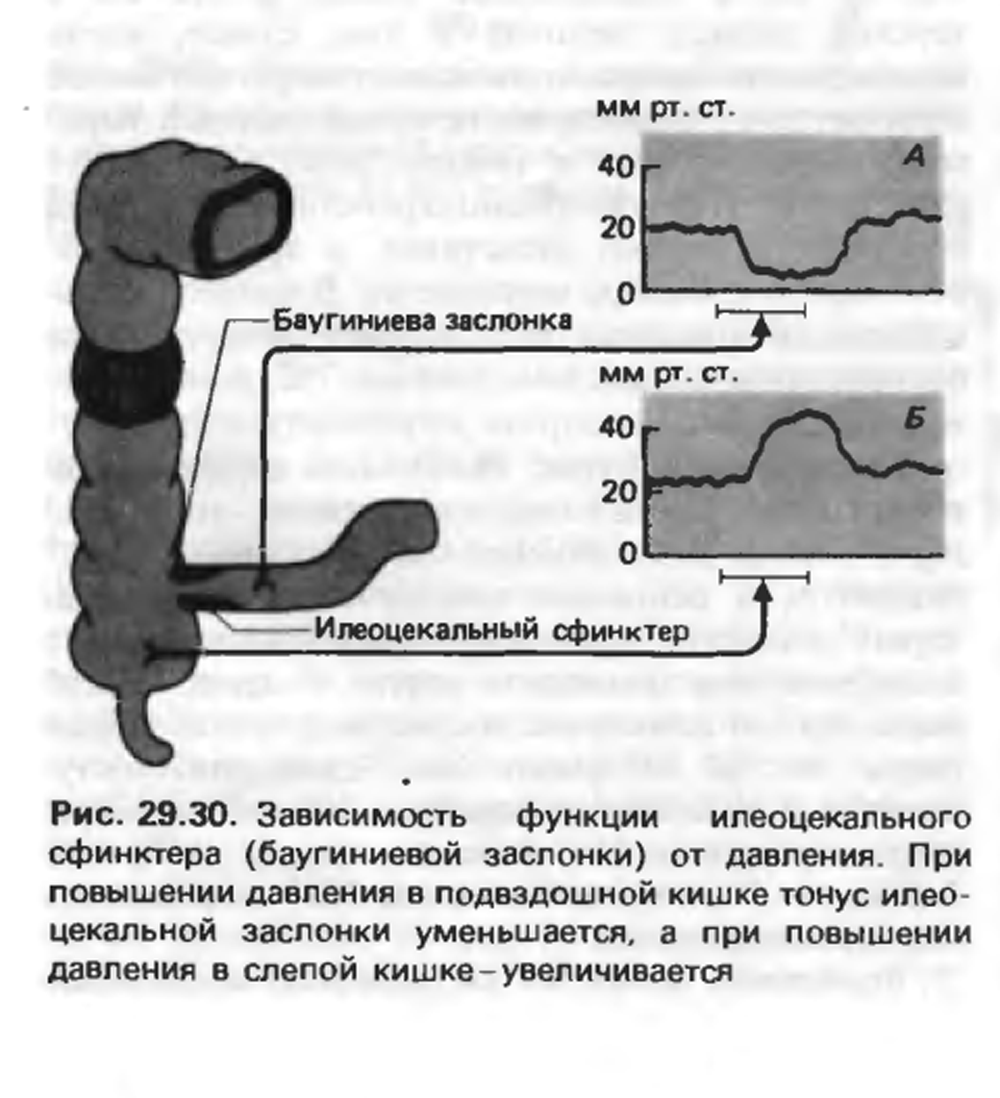 Баугиниевая заслонка где находится в кишечнике картинки